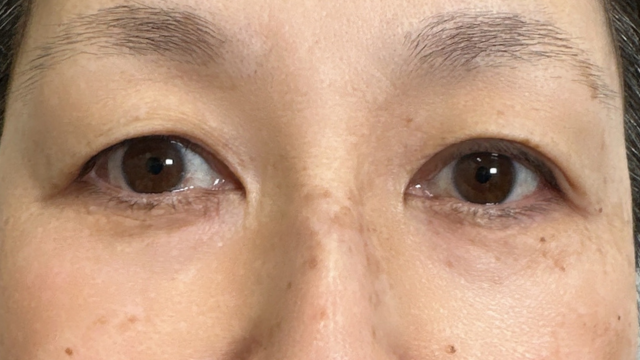 手术前的状态 其一