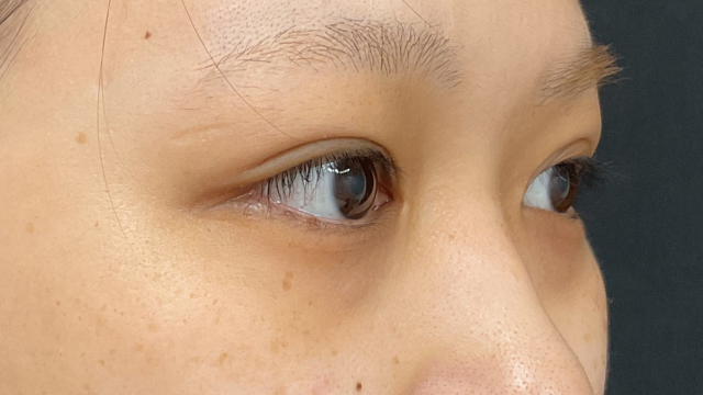 手术前的状态 其一