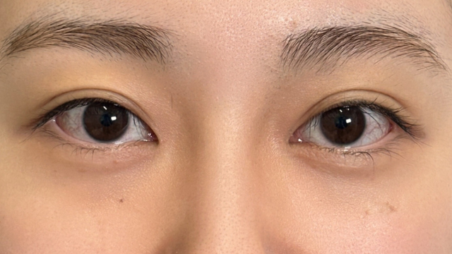 手术前的状态 其一