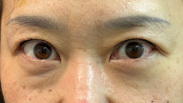 Postoperative Condition Part 1