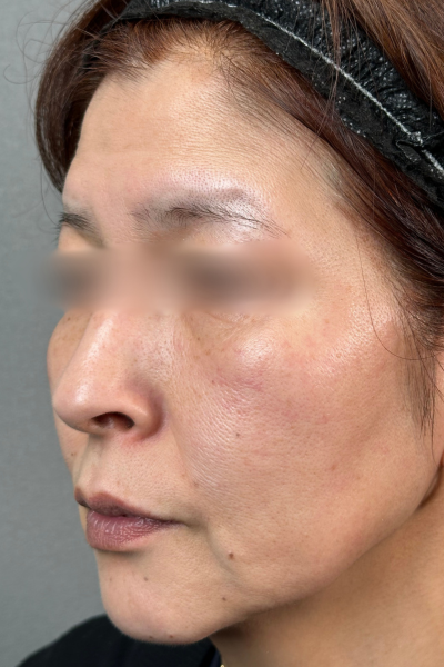 手術前の状態 その1