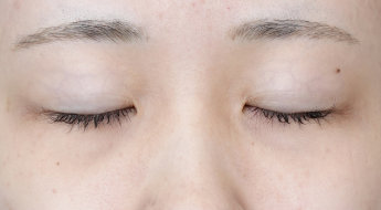 手術前の状態 その1