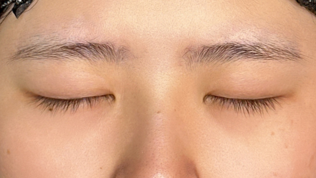 手术前的状态 其一