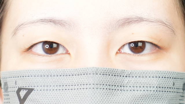 手術前の状態 その1