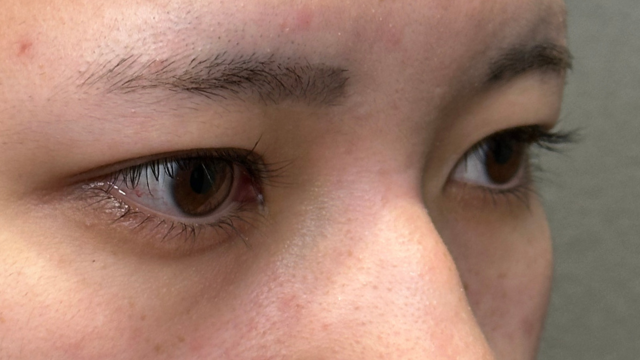 手術前の状態 その1