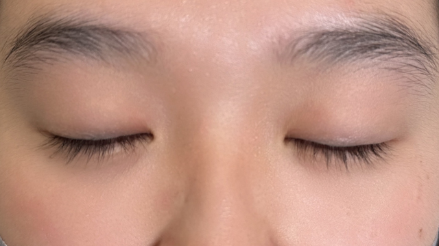 手术前的状态 其一