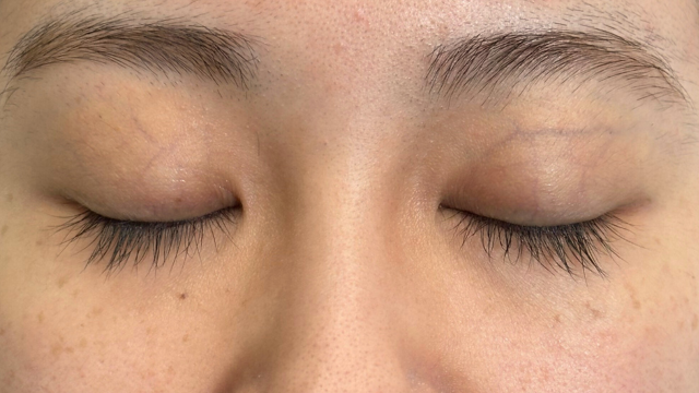 手术前的状态 其一