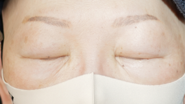 Postoperative Condition Part 1