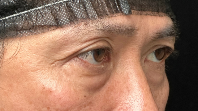 手术前的状态 其一