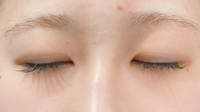 手术前的状态 其一