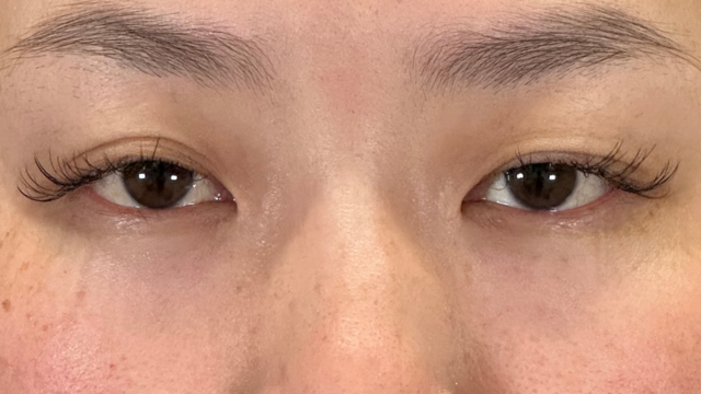 手术前的状态 其一