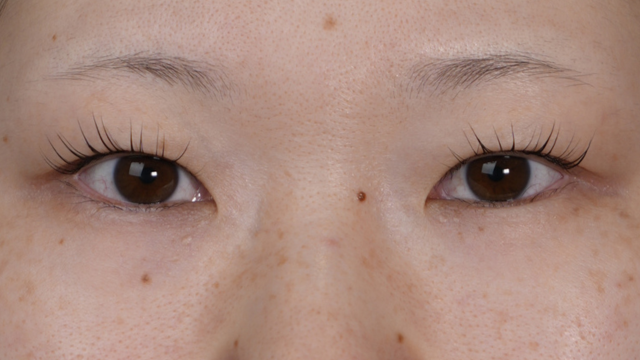 手术前的状态 其一