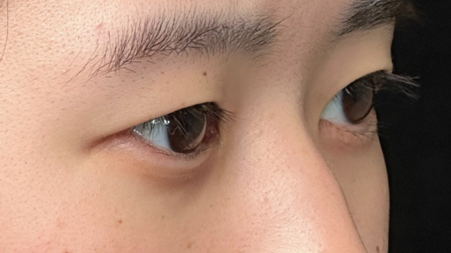 手术前的状态 其一