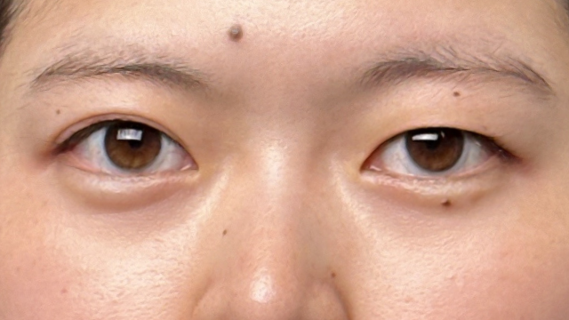 手术前的状态 其一