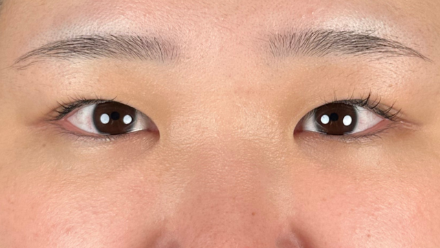 手术前的状态 其一