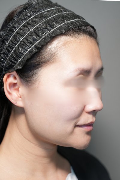 手術前の状態 その1