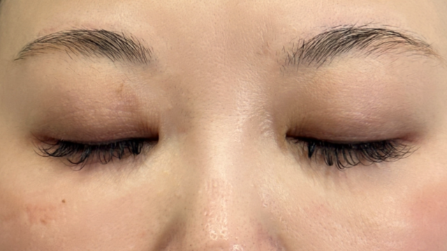 手术前的状态 其一