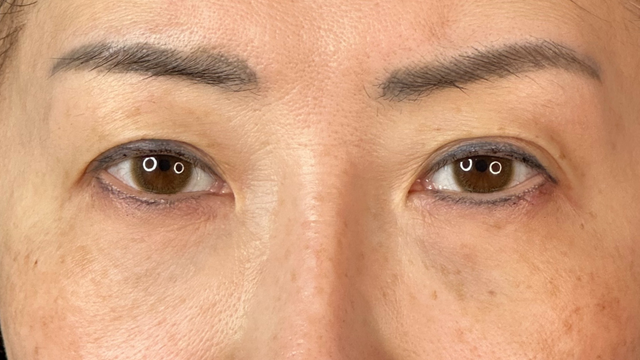 Postoperative Condition Part 1