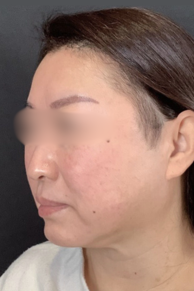 Postoperative Condition Part 1