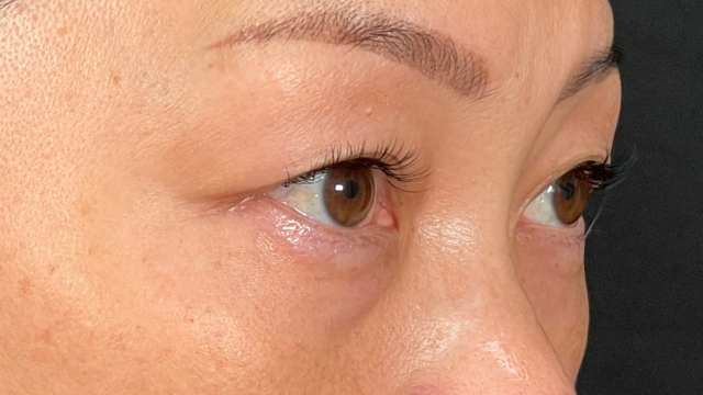 Postoperative Condition Part 1