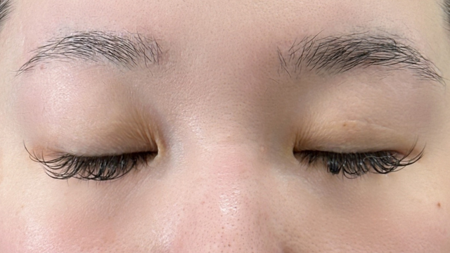 Postoperative Condition Part 1