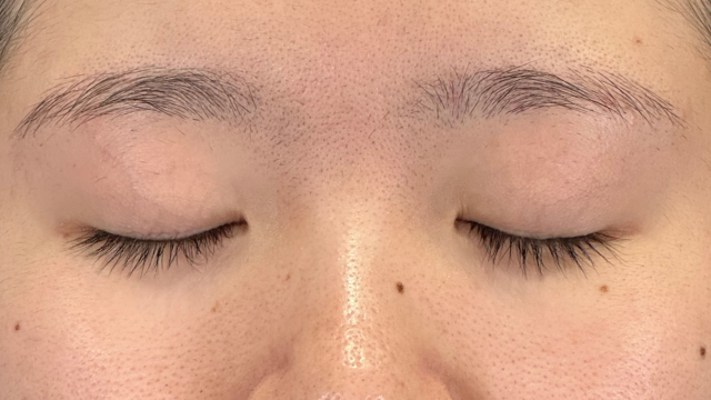 手术前的状态 其一