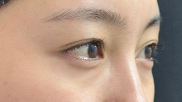 手术前的状态 其一