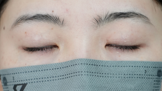 Postoperative Condition Part 1