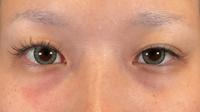 Postoperative Condition Part 1