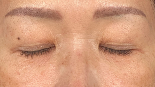 手術前の状態 その1