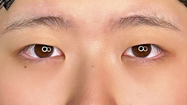 手术前的状态 其一