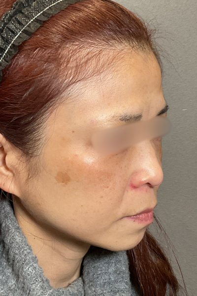 Postoperative Condition Part 1