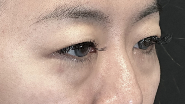 Postoperative Condition Part 1