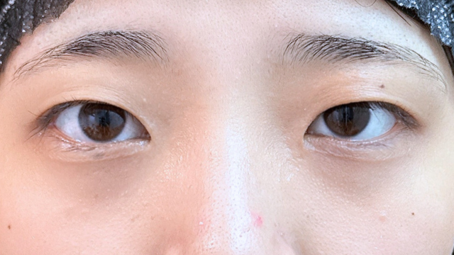 Postoperative Condition Part 1