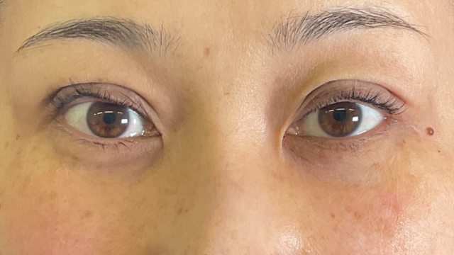 手术前的状态 其一