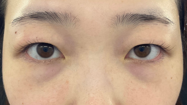 Postoperative Condition Part 1