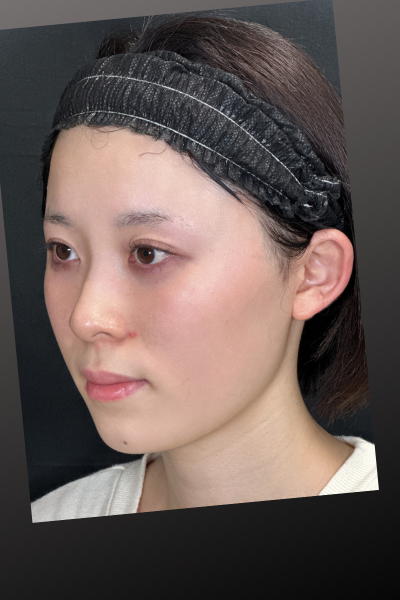 手術前の状態 その1