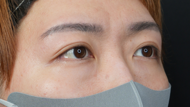 手术前的状态 其一