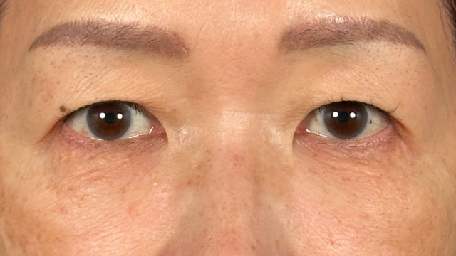 手術前の状態 その1