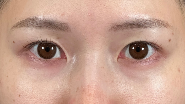 手术前的状态 其一