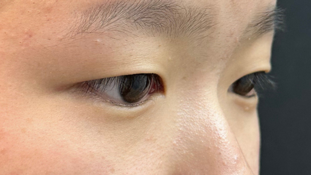 手术前的状态 其一