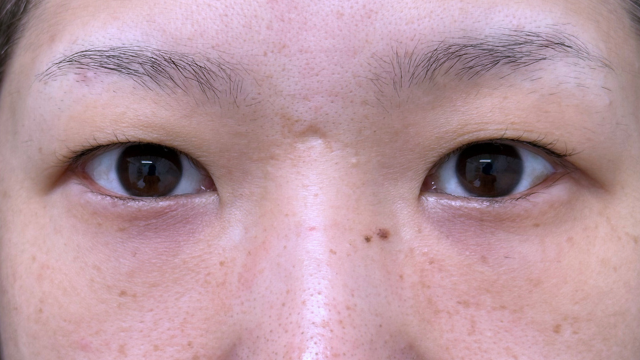 Postoperative Condition Part 1