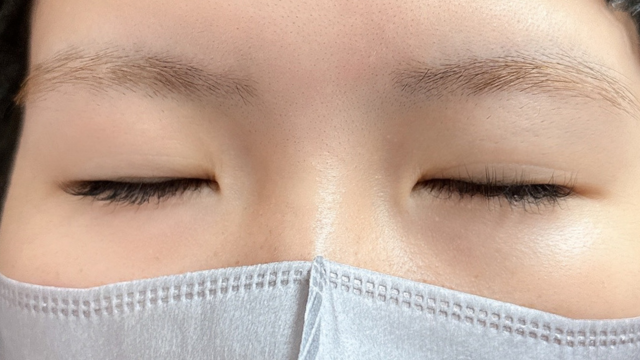 手术前的状态 其一