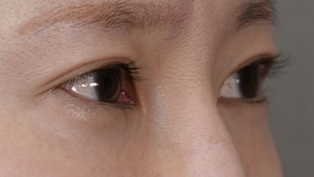 手术前的状态 其一