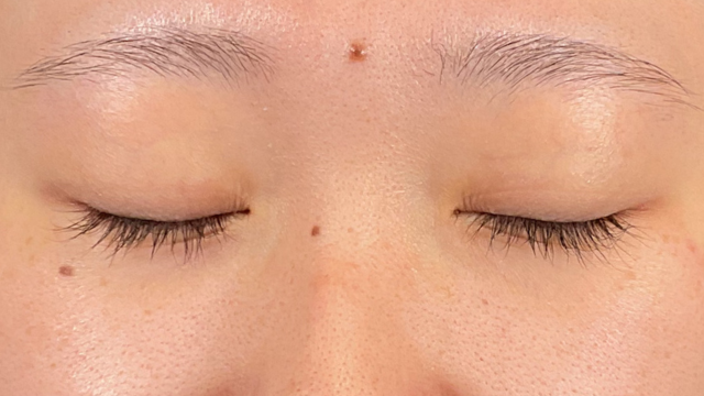 Postoperative Condition Part 1