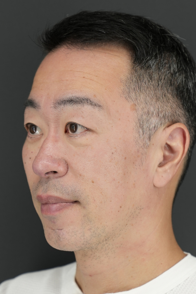 手術前の状態 その1