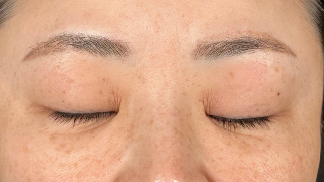 手术前的状态 其一