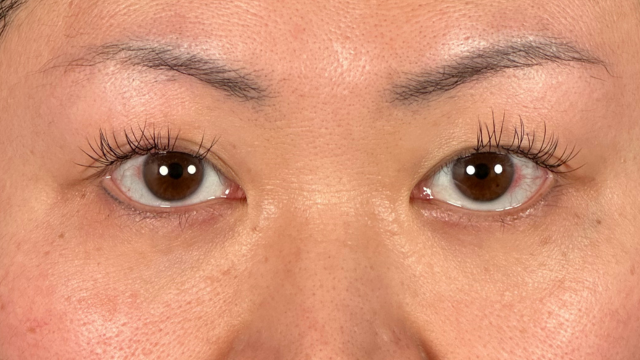 Postoperative Condition Part 1