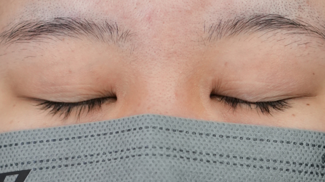 手术前的状态 其一