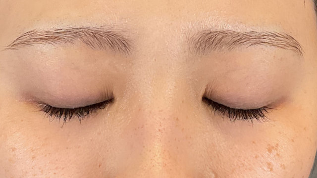 手术前的状态 其一